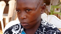 Abednego Solomon, slashed by Fulani militants who attacked his
village (Picture by Andrew Boyd)